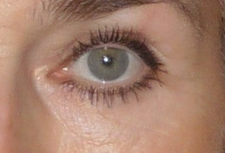 Before and After: Crow's Feet