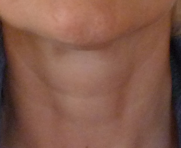 Before and After: Neck.Work your upper and lower body simultaneously with strength training exercises that target everything from muscles above your shoulders -face and neck - to your thighs